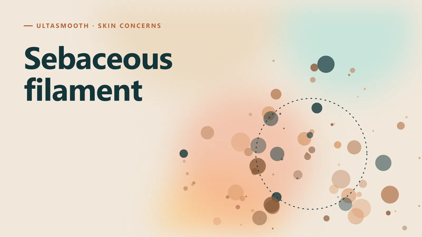 ภาพกราฟิกประกอบบทความ Sebaceous filament ต่างจากสิวหัวดำอย่างไร